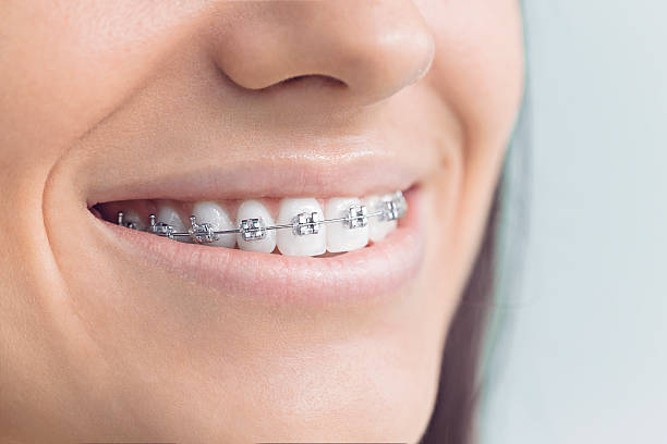 Best Dental Inlays and Onlays  in Grantsburg, WI